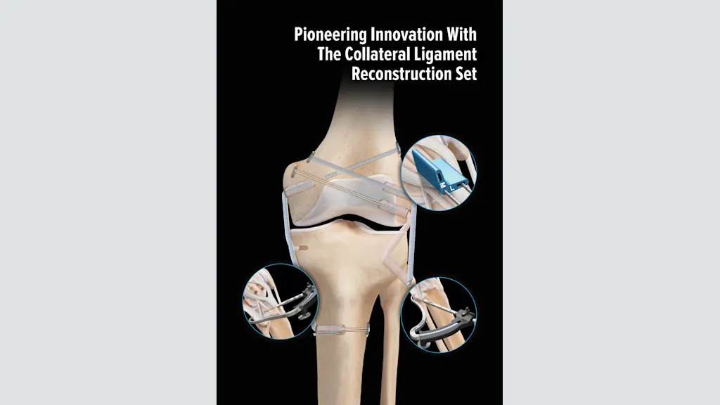 Pioneering Innovation With the Collateral Ligament Reconstruction Set