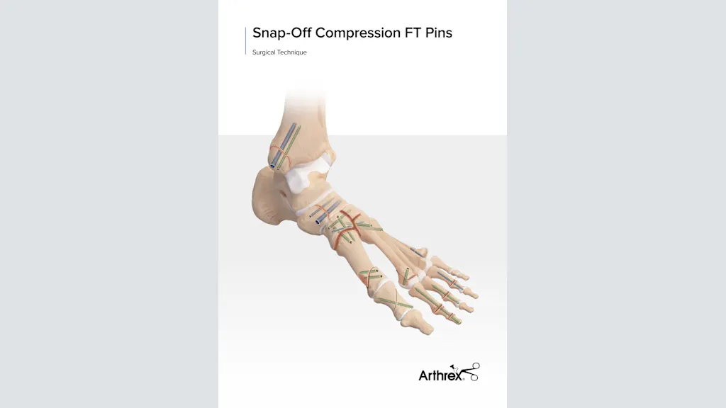 Snap-Off Compression FT Pins