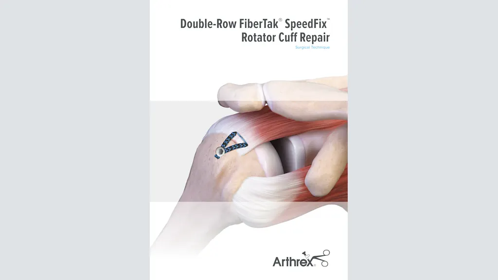 Double-Row FiberTak® SpeedFix™ Rotator Cuff Repair