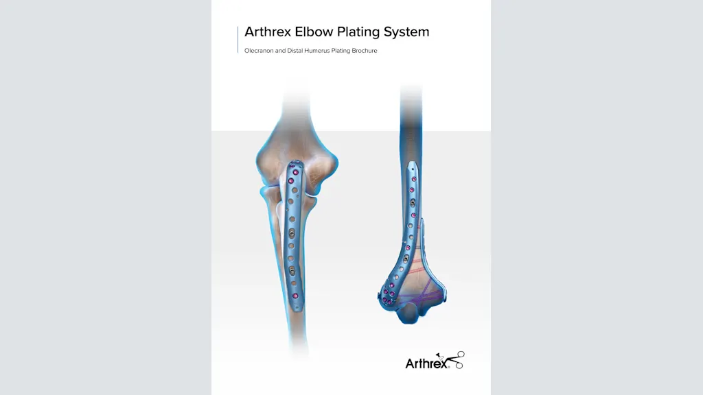 Arthrex Elbow Plating System - Olecranon and Distal Humerus Plating