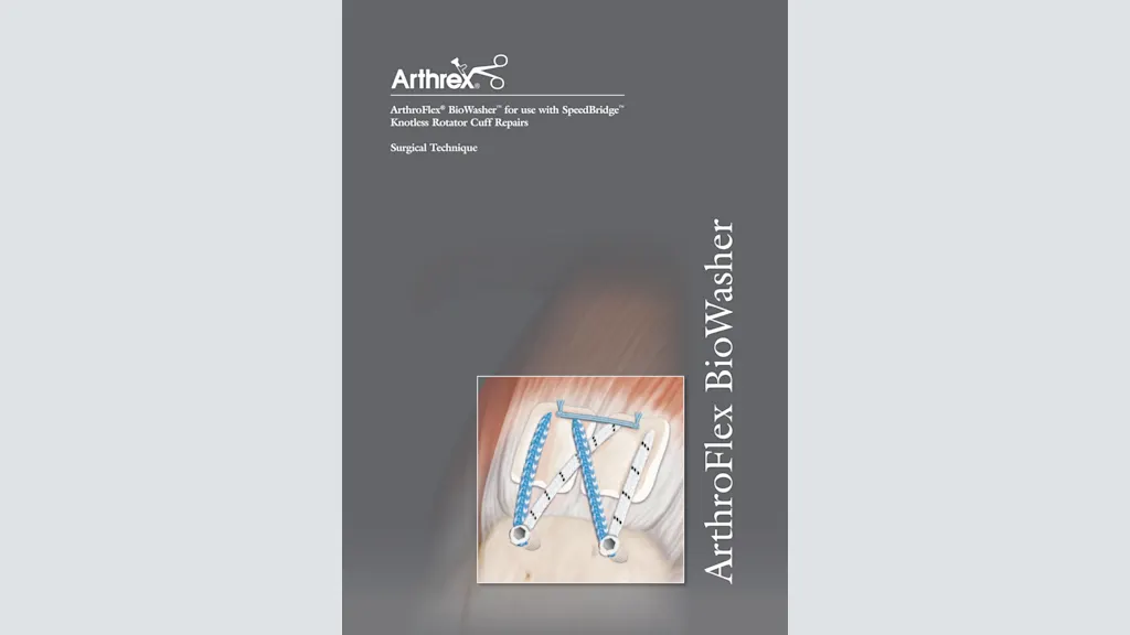 ArthroFlex® BioWasher™ for use with SpeedBridge™ Knotless Rotator Cuff Repairs