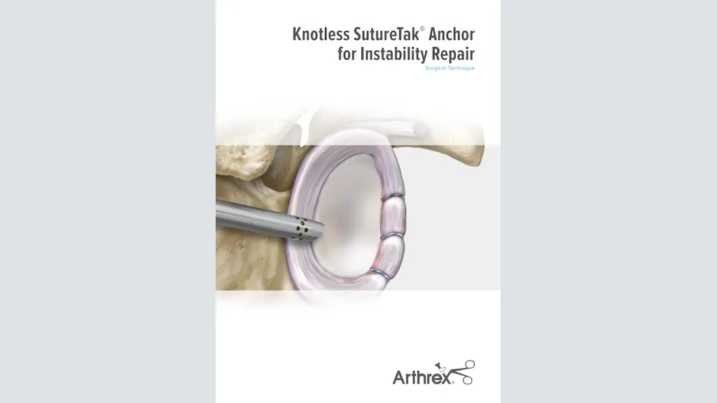 Knotless SutureTak® Anchor for Instability Repair