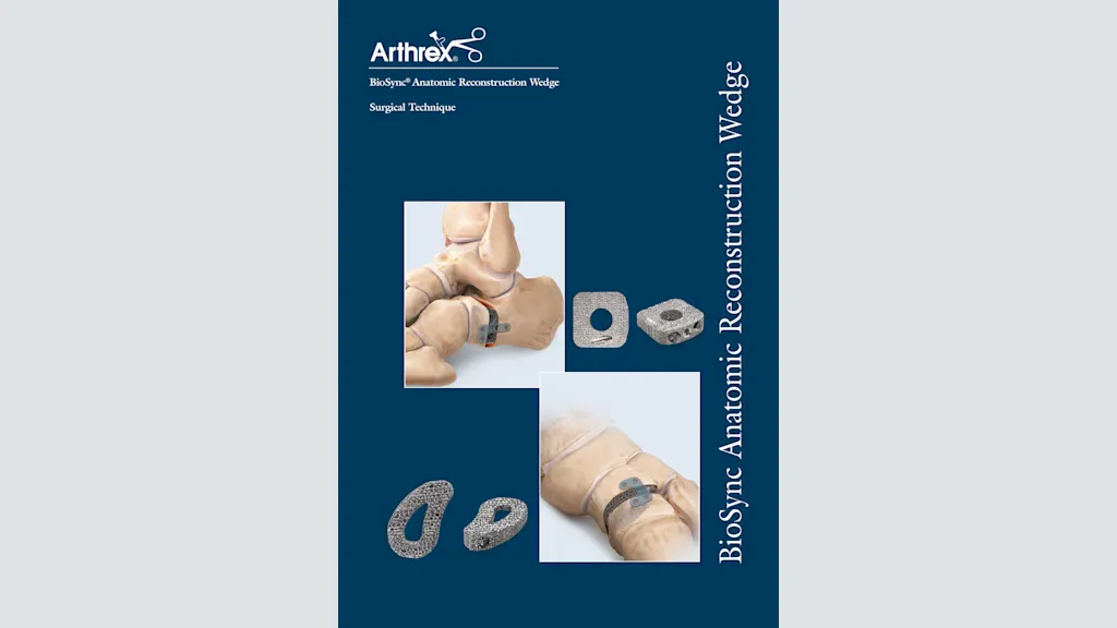 BioSync® Anatomic Reconstruction Wedge