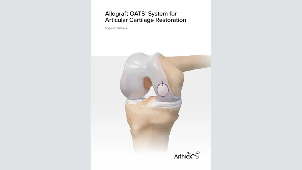 Allograft OATS® System for Articular Cartilage Restoration