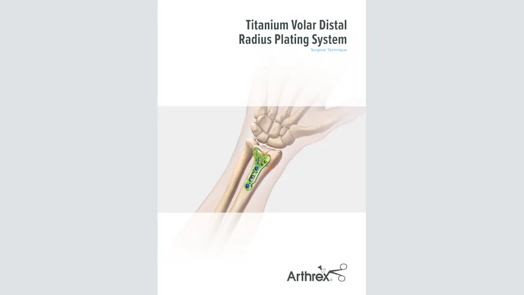 Titanium Volar Distal Radius Plating System