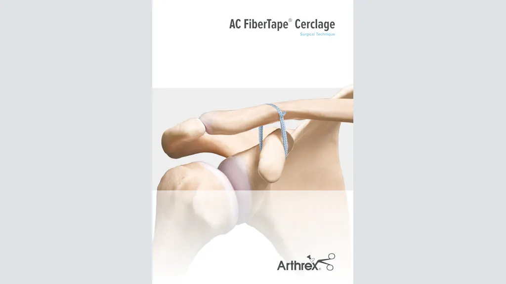AC FiberTape® Cerclage