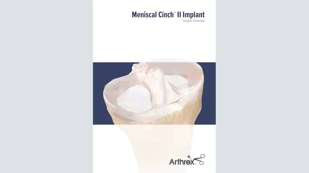 Meniscal Cinch™ II Implant