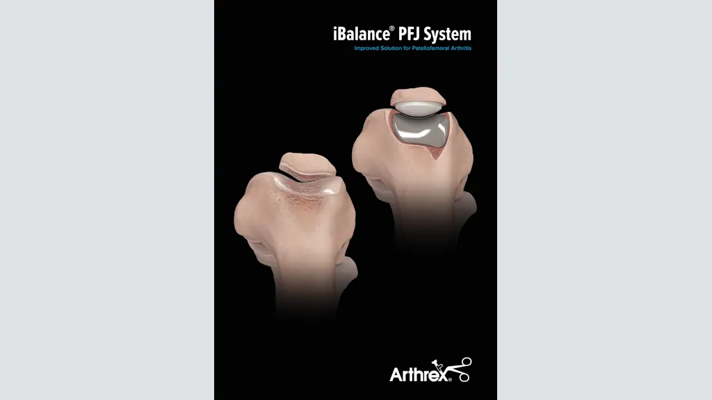 iBalance® PFJ System - Improved Solution for Patellofemoral Arthritis