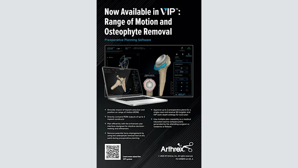 Now Available in VIP™: Range of Motion and Osteophyte Removal