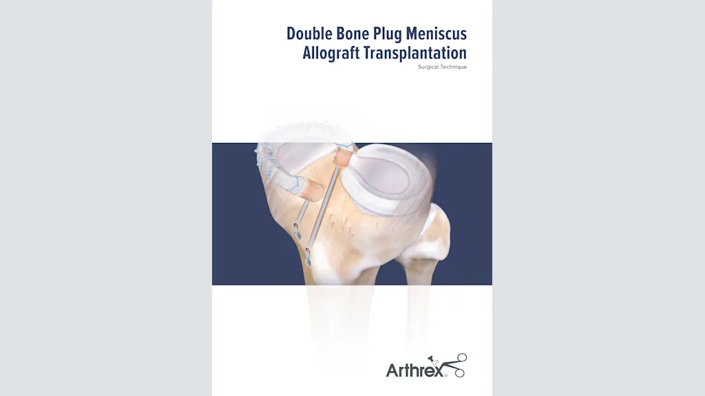 Double Bone Plug Meniscus Reconstruction