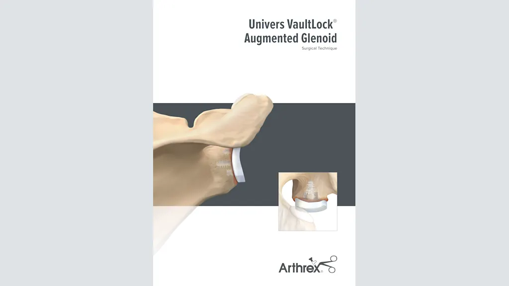 Univers VaultLock® Augmented Glenoid