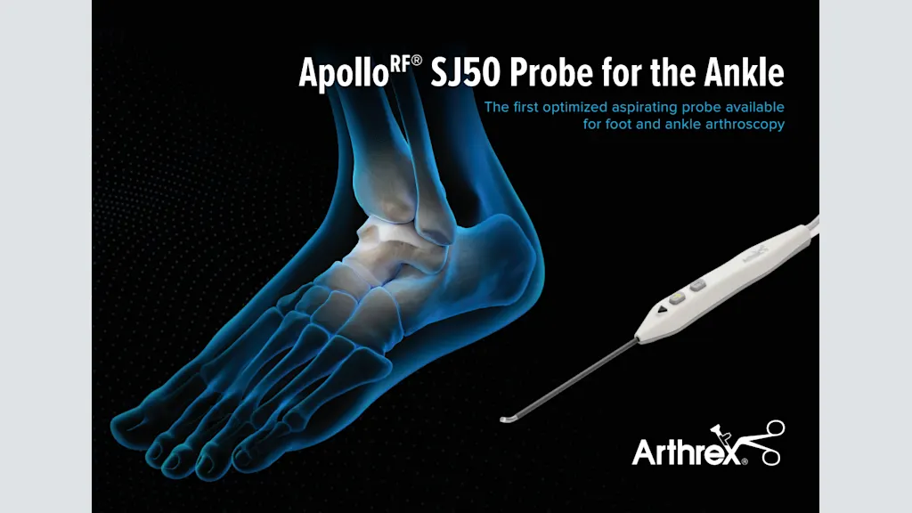 Apollo<sup>RF®</sup> SJ50 Probe for the Ankle