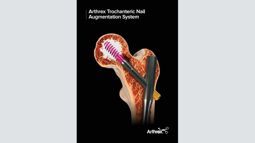 Arthrex Trochanteric Nail Augmentation System