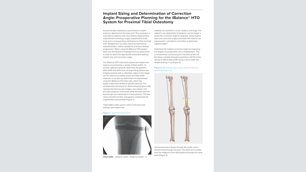 Implant Sizing and Determination of Correction Angle: Preoperative Planning for the iBalance® HTO System for Proximal Tibial Osteotomy