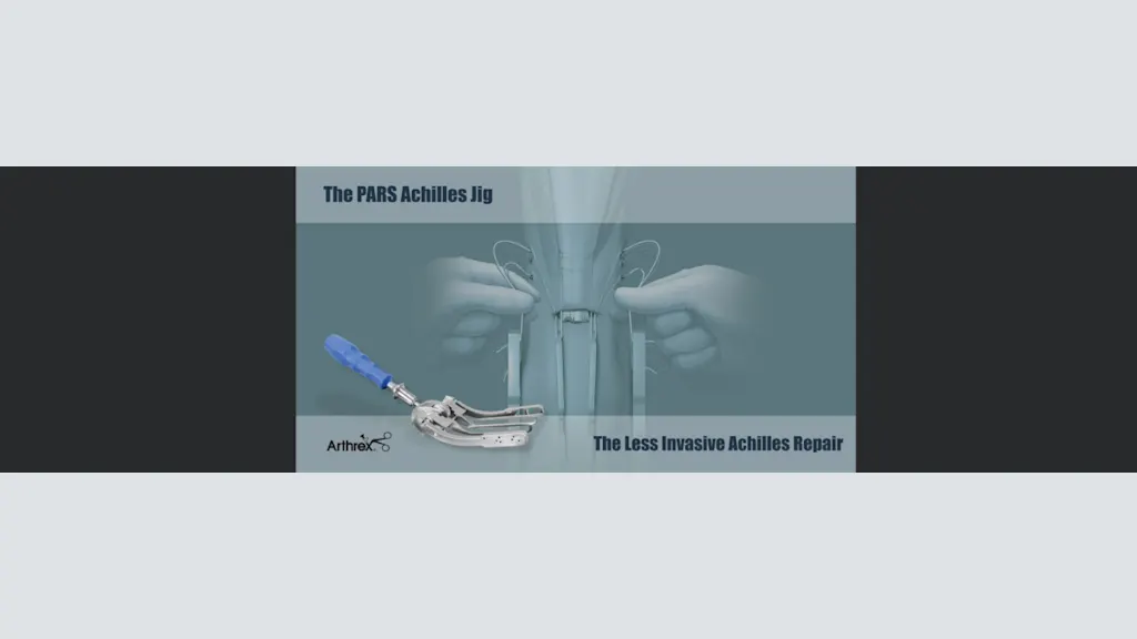 The PARS Achilles Jig: The Less Invasive Achilles Repair