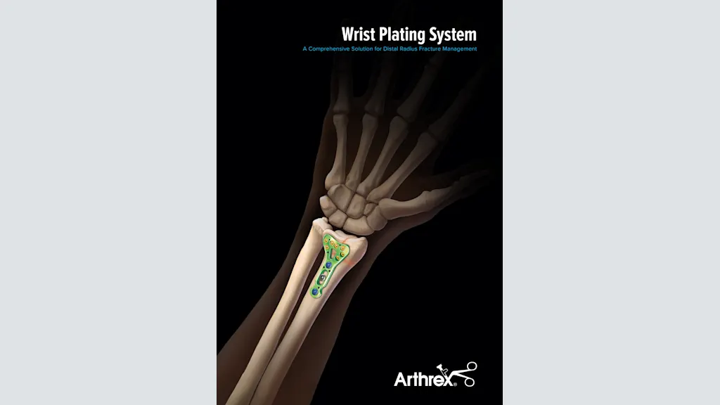 Wrist Plating System