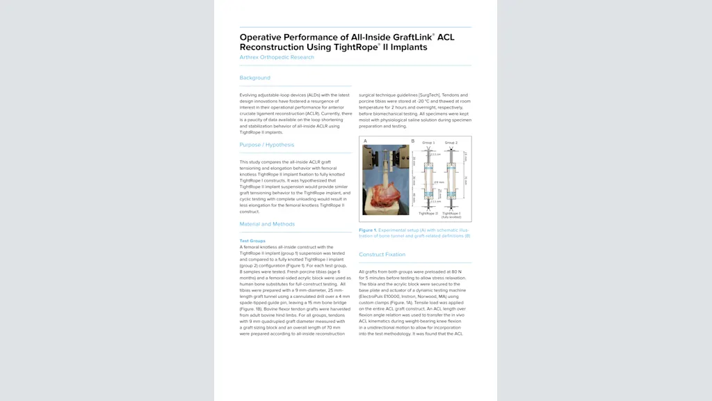 Operative Performance of All-Inside GraftLink® ACL Reconstruction Using TightRope® II Implants