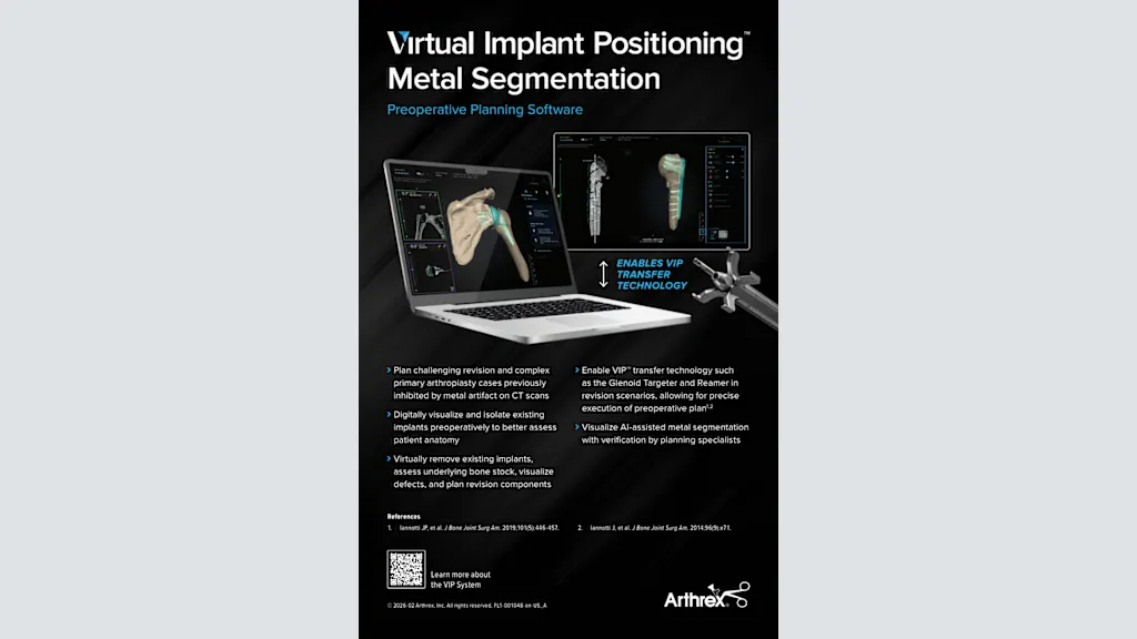 Arthrex - Virtual Implant Positioning™ (VIP™) System