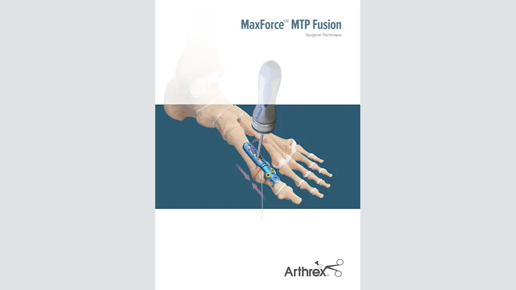 MaxForce™ MTP Fusion