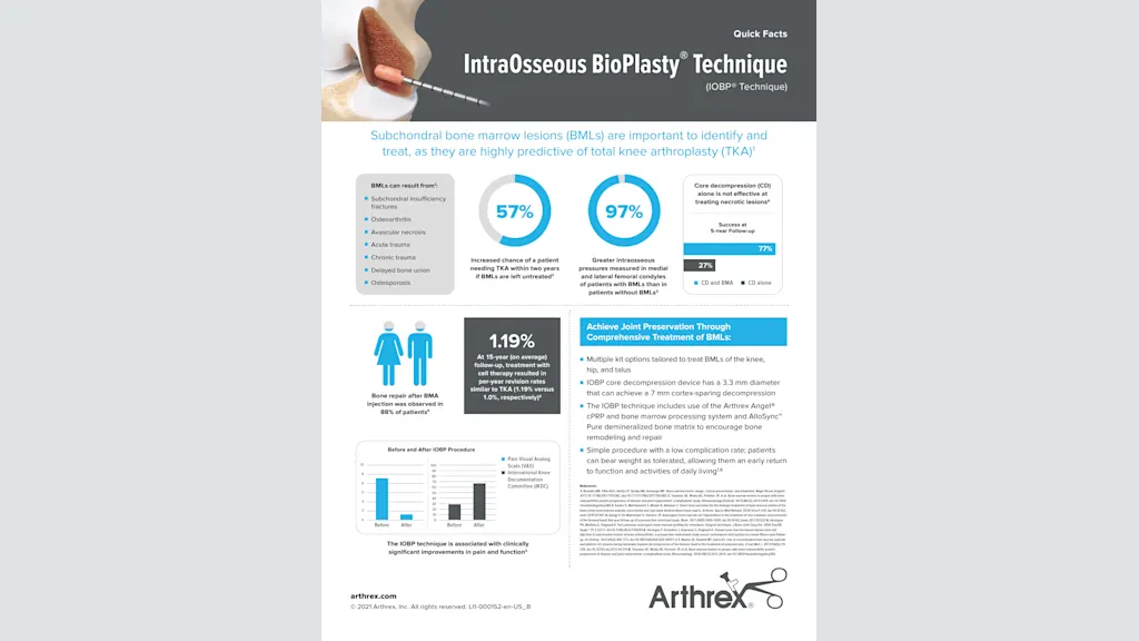 IntraOsseous BioPlasty® Technique