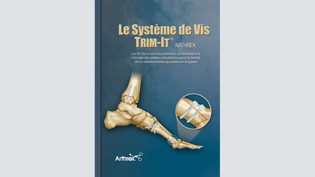 Le Système de Vis Trim-It™