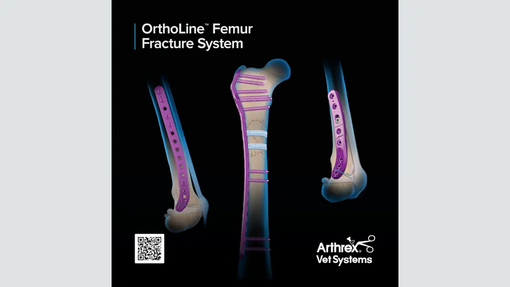 OrthoLine™  Femur Fracture System