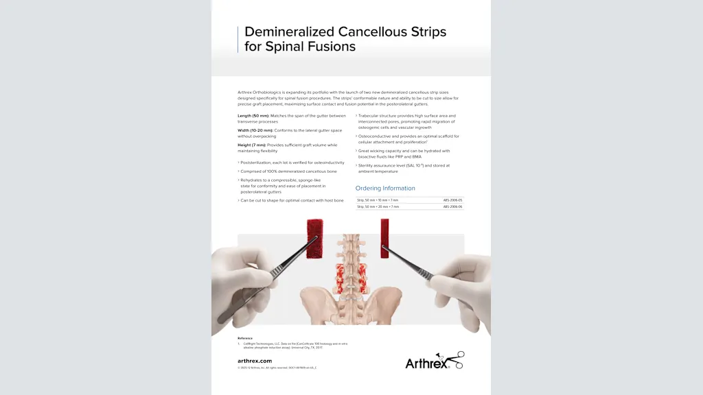 Arthrex - AlloSync™ Bone Grafting Solutions