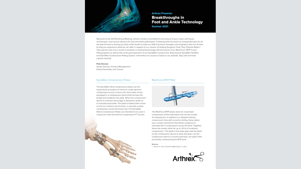 Arthrex Presents: Breakthroughs in Foot and Ankle Technology
