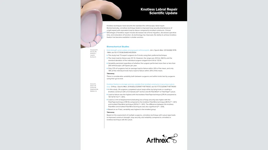 Knotless Labral Repair Scientific Update