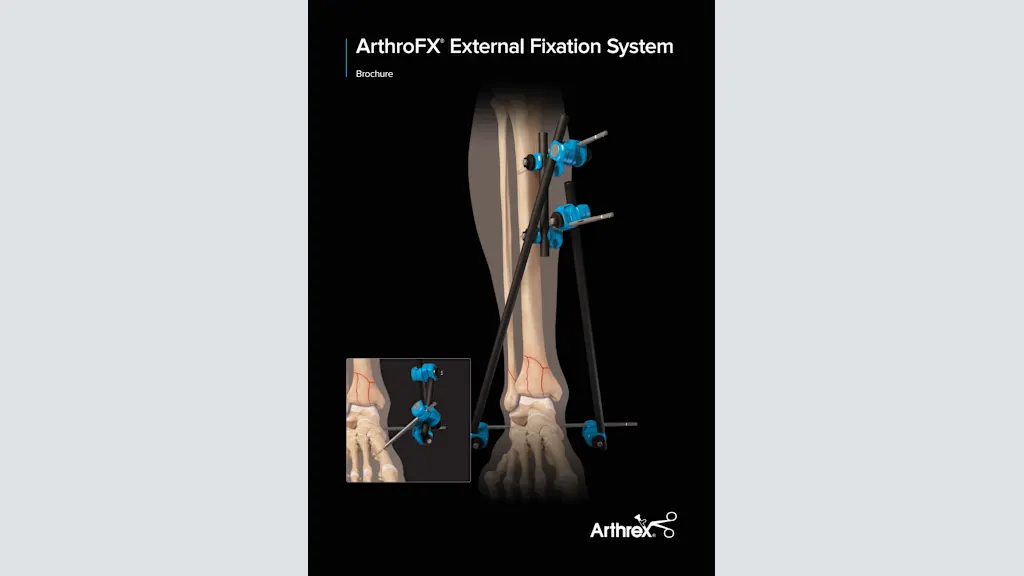 Arthrex - ArthroFX® Large External Fixation System
