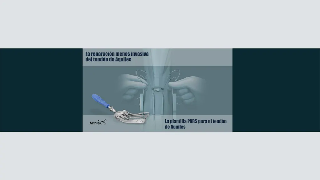 Plantilla PARS para el tendón de Aquiles: una reparación menos invasiva