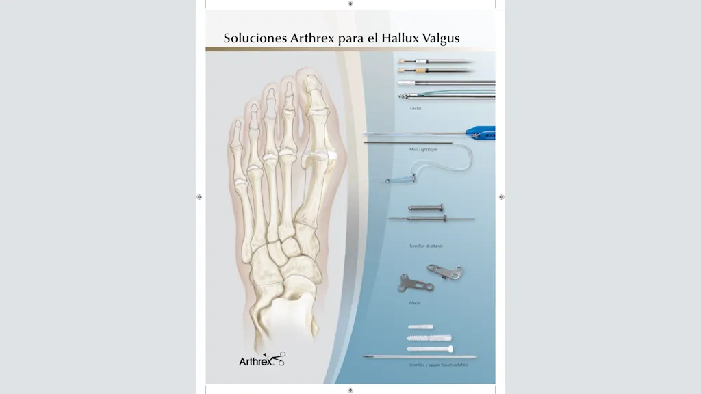 Soluciones Arthrex para el Hallux Valgus