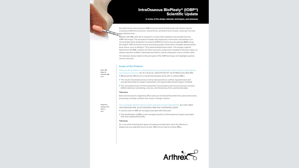 IntraOsseous BioPlasty® (IOBP®) Scientific Update