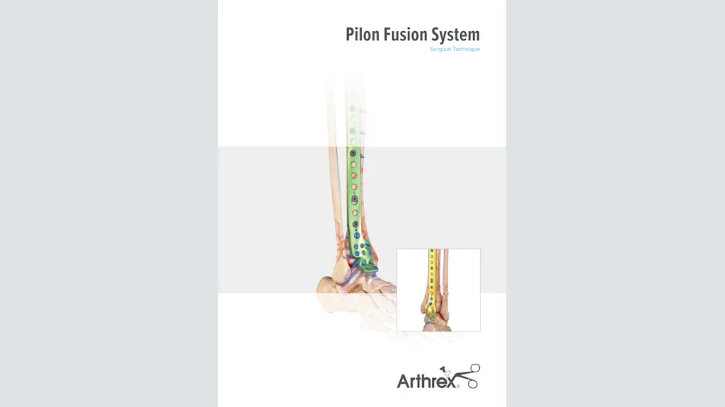 Pilon Fusion System