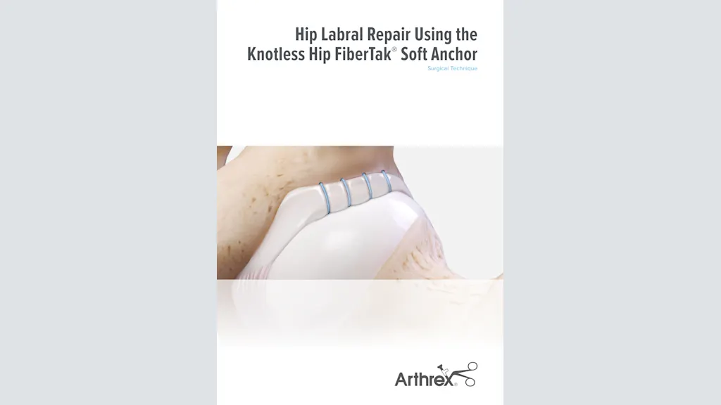 Hip Labral Repair Using the Knotless Hip FiberTak® Soft Anchor