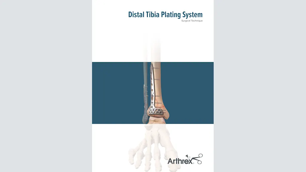 Distal Tibia Plating System