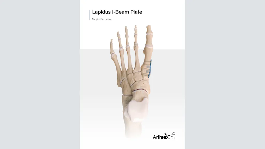 Arthrex - Lapidus I-Beam Plates