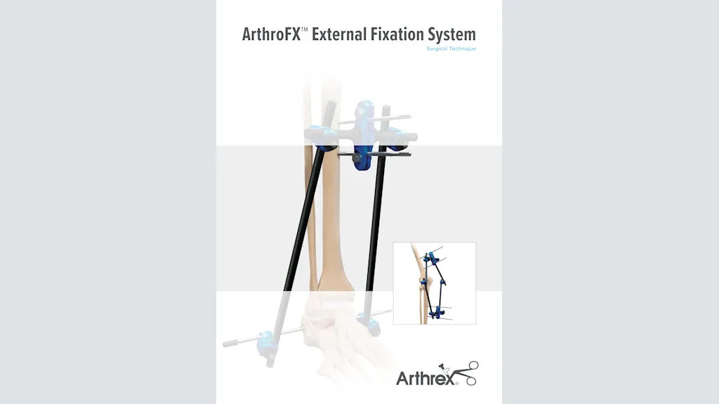ArthroFX™ External Fixation System