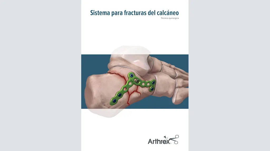 Sistema para fracturas del calcáneo
