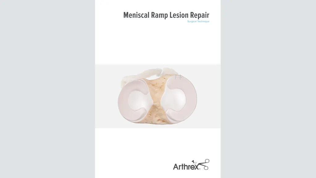 Meniscus Ramp Lesion Repair