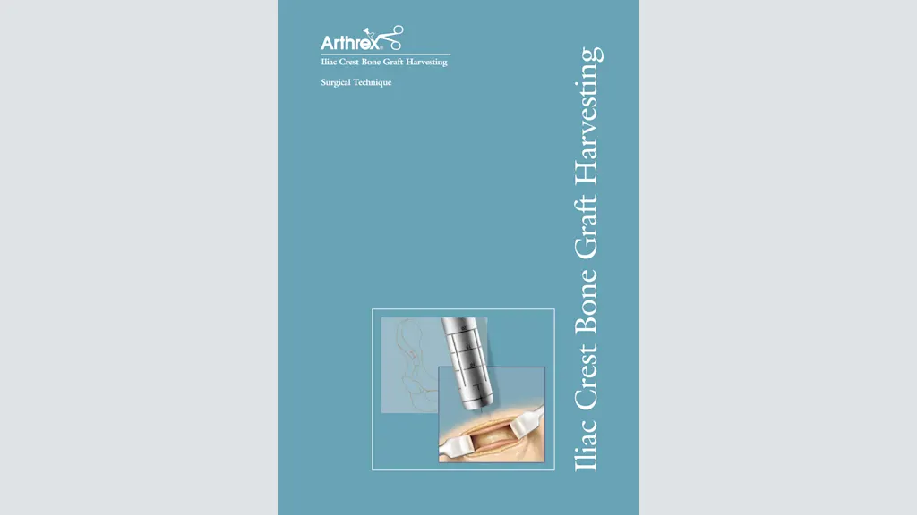 Iliac Crest Bone Graft Harvesting