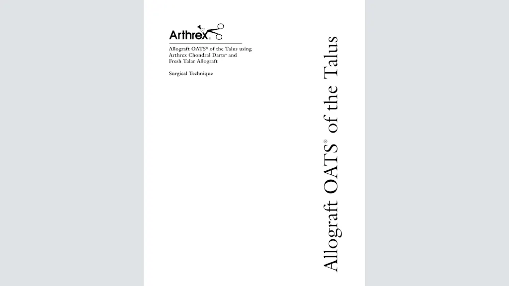 Allograft OATS® of the Talus using Arthrex Chondral Darts™ and Fresh Talar Allograft