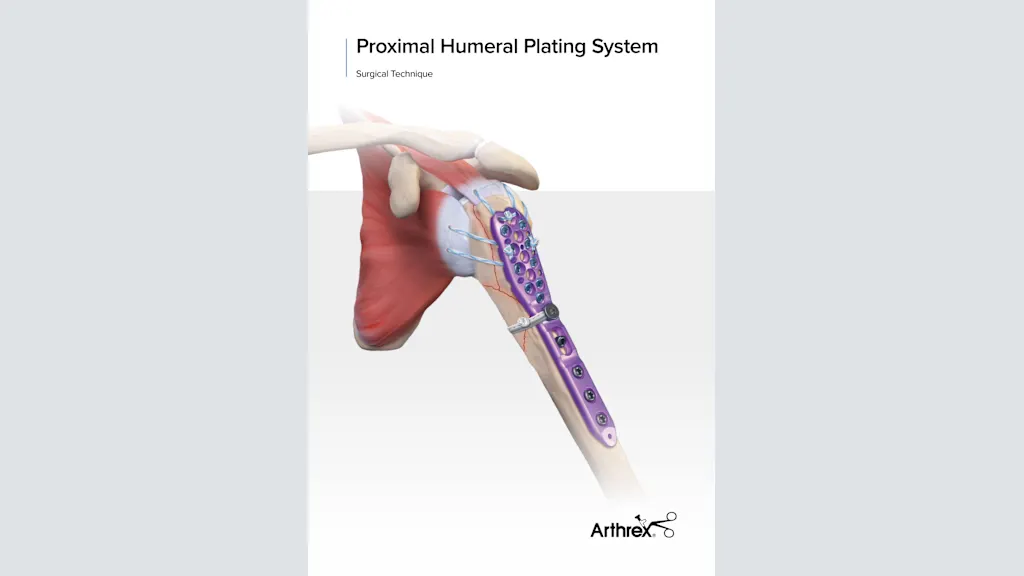 Proximal Humeral Plating System