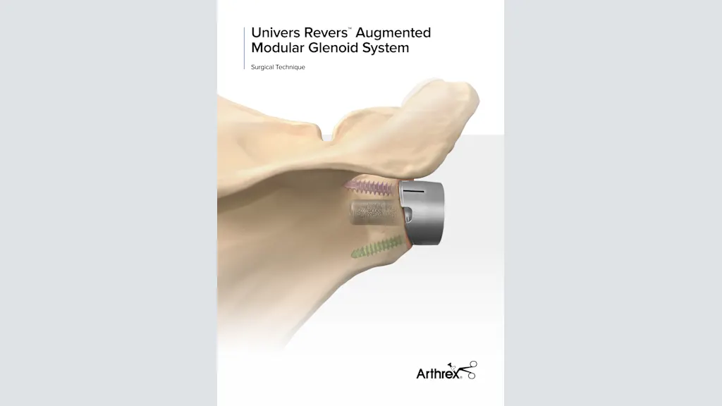 Univers Revers™ Augmented Modular Glenoid System