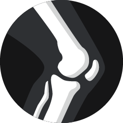 A basic white outline of knee bones.