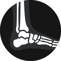 A basic white outline of foot and ankle bones.