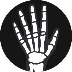 A basic white outline of hand and wrist bones.