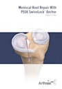 Arthrex - Meniscal Repair