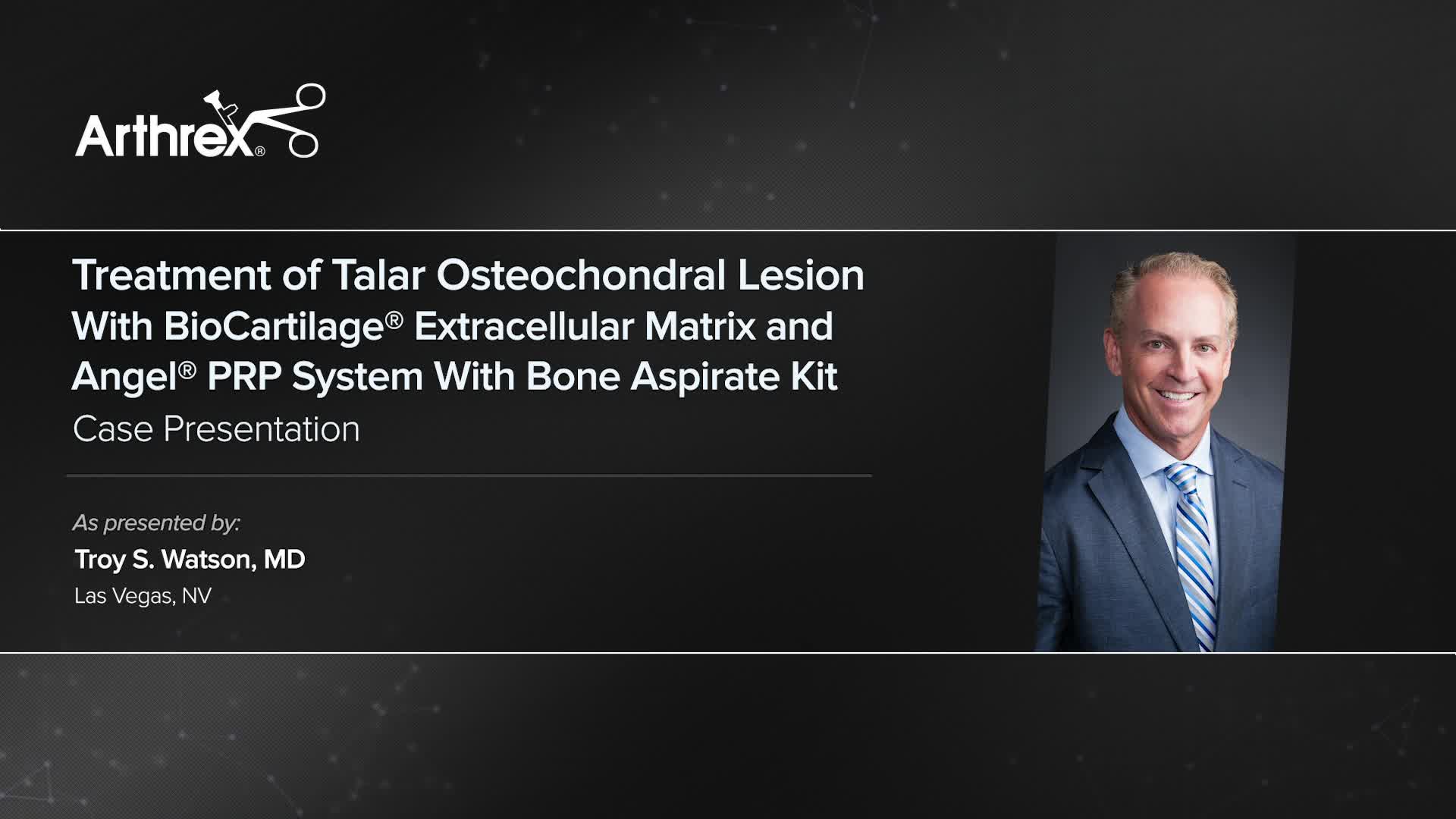 Arthrex - Treatment Of Talar Osteochondral Lesion With BioCartilage ...