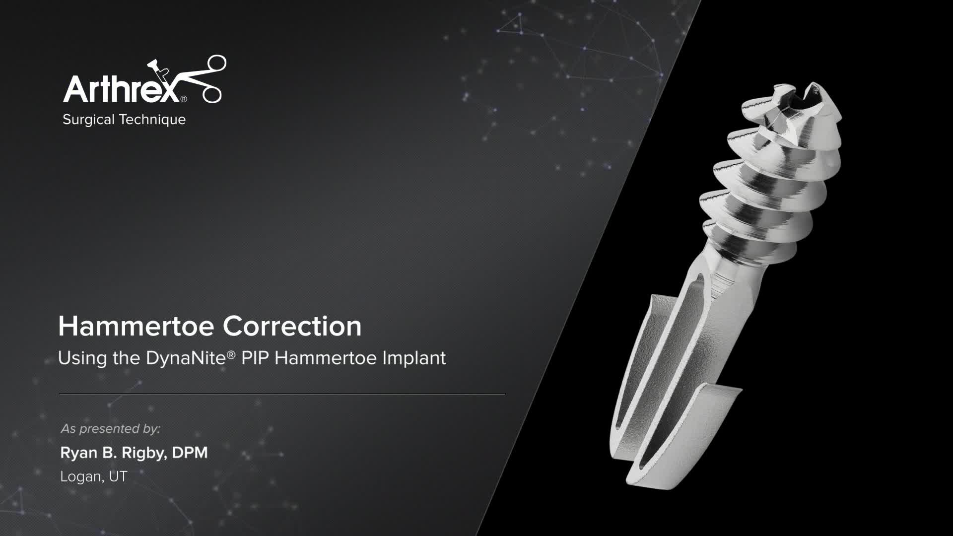 Arthrex - Hammertoe Correction Using the DynaNite® PIP